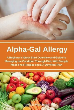 Alpha-Gal Allergy: A Beginner's Quick Start Overview and Guide to Managing the Condition Through Diet, with Sample Meat-Free Recipes and a 7-Day Meal Plan by Patrick Marshwell 9798330466191