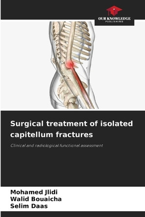 Surgical treatment of isolated capitellum fractures by Mohamed Jlidi 9786207897599