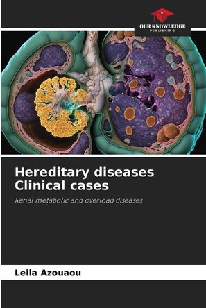 Hereditary diseases Clinical cases by Leila Azouaou 9786208260439