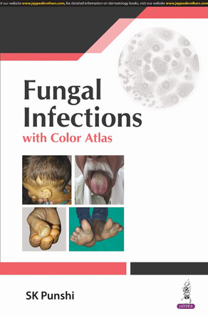 Fungal Infections: with Color Atlas by SK Punshi 9789356965911