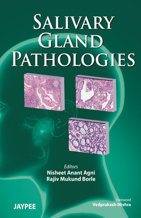 Salivary Gland Pathologies by Nisheet Anant Agni 9789380704722