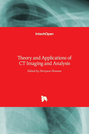 Theory and Applications of CT Imaging and Analysis by Noriyasu Homma 9789533072340