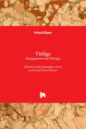 Vitiligo: Management and Therapy by Kelly Park 9789533077314