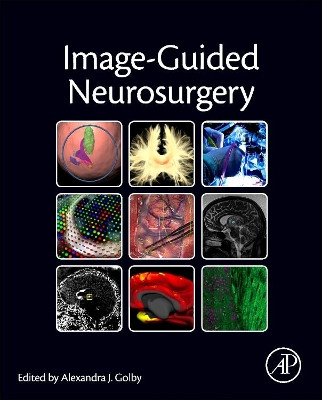 Image-Guided Neurosurgery by Alexandra J. Golby 9780128008706