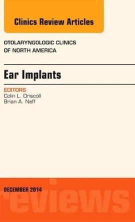 Ear Implants, An Issue of Otolaryngologic Clinics of North America by  9780323340427
