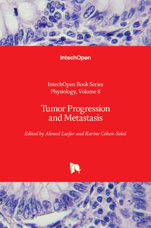 Tumor Progression and Metastasis by Ahmed Lasfar 9781789853490