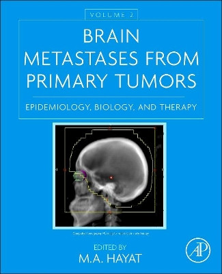 Brain Metastases from Primary Tumors, Volume 2: Epidemiology, Biology, and Therapy by  9780128014196