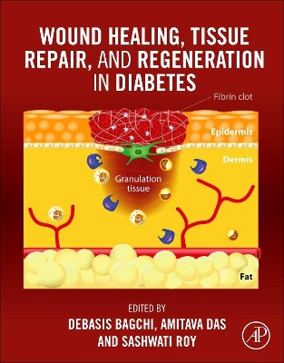 Wound Healing, Tissue Repair and Regeneration in Diabetes by Debasis Bagchi 9780128164136