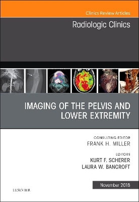 Imaging of the Pelvis and Lower Extremity, An Issue of Radiologic Clinics of North America by Laura Bancroft 9780323641555