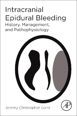 Intracranial Epidural Bleeding: History, Management, and Pathophysiology by Jeremy Christopher Ganz 9780128121597