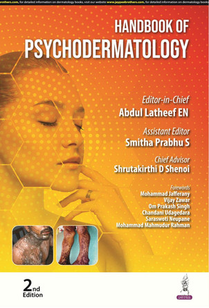 Handbook of Psychodermatology by Abdul Latheef EN 9789356964570