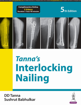 Tanna’s Interlocking Nailing by DD Tanna 9789356964907