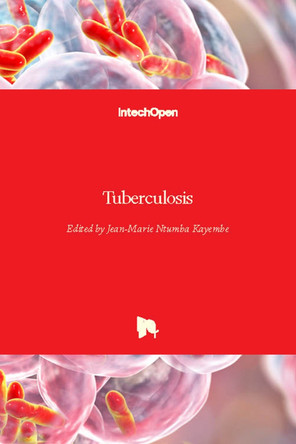 Tuberculosis by Jean-Marie Ntumba Kayembe 9781789237818