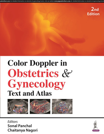 Color Doppler in Obstetrics & Gynecology: Text and Atlas by Sonal Panchal 9789356969605