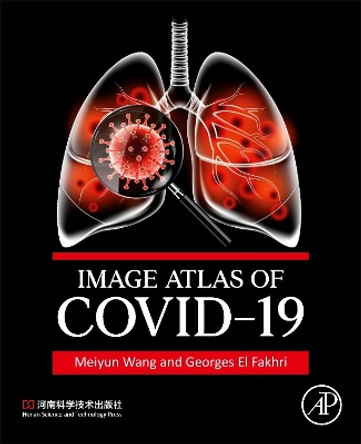 Image Atlas of COVID-19 by Meiyun Wang 9780443184932