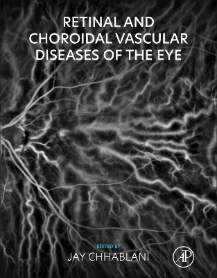 Retinal and Choroidal Vascular Diseases of the Eye by Jay Chhablani 9780443155833