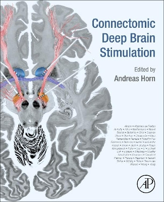 Connectomic Deep Brain Stimulation by Andreas Horn 9780128218617