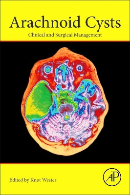 Arachnoid Cysts: Clinical and Surgical Management by Knut Wester 9780128143780
