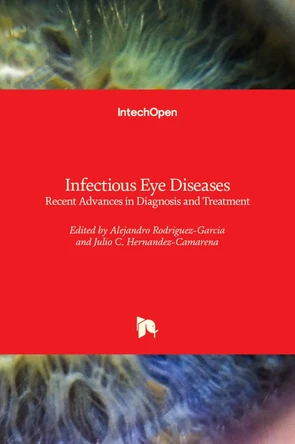 Infectious Eye Diseases: Recent Advances in Diagnosis and Treatment by Alejandro Rodriguez-Garcia 9781839693199