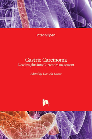 Gastric Carcinoma: New Insights into Current Management by Daniela Lazar 9789535109143