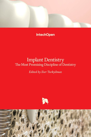 Implant Dentistry: The Most Promising Discipline of Dentistry by Ilser Turkyilmaz 9789533074818