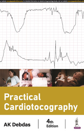 Practical Cardiotocography by AK Debdas 9789356964433