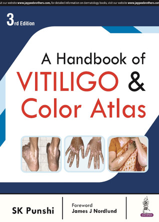 A Handbook of Vitiligo & Color Atlas by SK Punshi 9789356962873