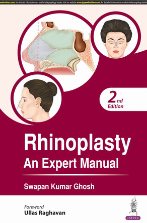 Rhinoplasty: An Expert Manual by Swapan Kumar Ghosh 9789354652110
