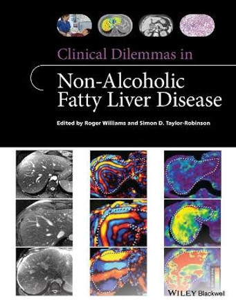 Clinical Dilemmas in Non-Alcoholic Fatty Liver Disease by Roger Williams