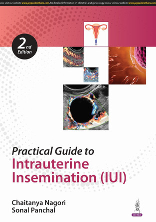 Practical Guide to Intrauterine Insemination (IUI) by Chaitanya Nagori 9789366166537
