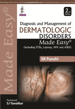 Diagnosis and Management of Dermatologic Disorders Made Easy by S. K. Punshi 9789351527930