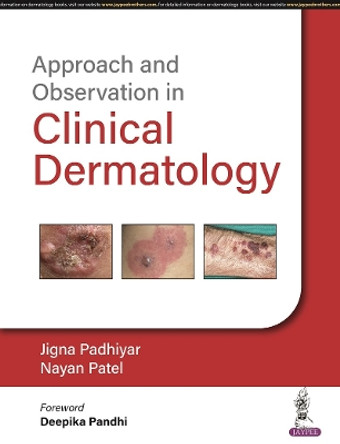 Approach and Observation in Clinical Dermatology by Jigna Padhiyar 9789356960831