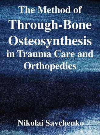 The Method of Through-Bone Osteosynthesis in Trauma Care and Orthopedics by Nikolai Ivanovich Savchenko 9781087866406
