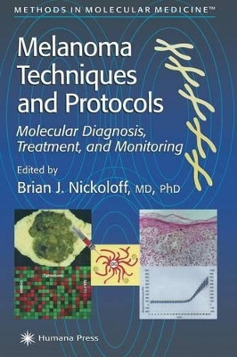 Melanoma Techniques and Protocols: Molecular Diagnosis, Treatment, and Monitoring by Brian J. Nickoloff 9781617371349