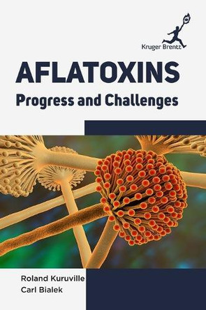 Aflatoxins: Progress and Challenges by Alan Eaton 9781787150362