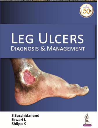 Leg Ulcers: Diagnosis & Management by S Sacchidanand 9789352709397