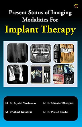 Present Status of Imaging Modalities For Implant Therapy by Dr Jayshri Nandanwar 9789354461989