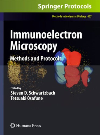 Immunoelectron Microscopy: Methods and Protocols by Steven D. Schwartzbach 9781493957583