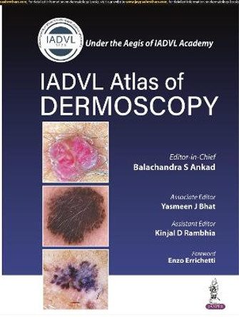 Atlas of Dermoscopy by Balachandra S Ankad