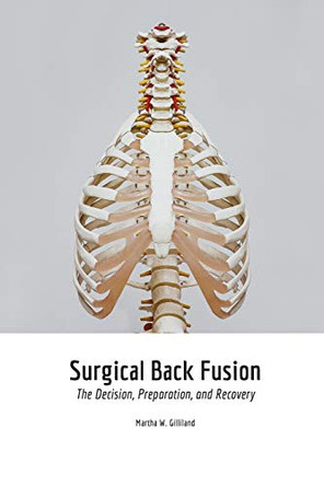Surgical Back Fusion by Martha Gilliland 9781715416683