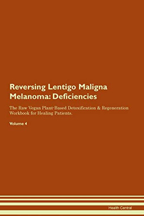 Reversing Lentigo Maligna Melanoma: Deficiencies The Raw Vegan Plant-Based Detoxification & Regeneration Workbook for Healing Patients. Volume 4 by Health Central 9781395373979