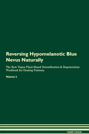 Reversing Hypomelanotic Blue Nevus Naturally The Raw Vegan Plant-Based Detoxification & Regeneration Workbook for Healing Patients. Volume 2 by Health Central 9781395247461