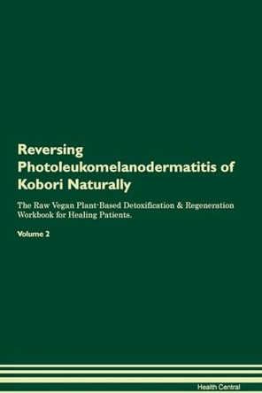 Reversing Photoleukomelanodermatitis of Kobori Naturally The Raw Vegan Plant-Based Detoxification & Regeneration Workbook for Healing Patients. Volume 2 by Health Central 9781395259709
