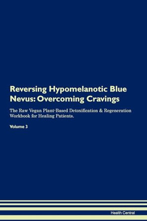 Reversing Hypomelanotic Blue Nevus: Overcoming Cravings The Raw Vegan Plant-Based Detoxification & Regeneration Workbook for Healing Patients. Volume 3 by Health Central 9781395293758