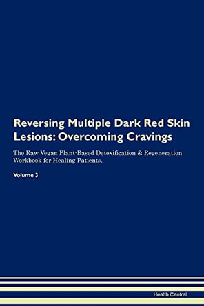Reversing Multiple Dark Red Skin Lesions: Overcoming Cravings The Raw Vegan Plant-Based Detoxification & Regeneration Workbook for Healing Patients. Volume 3 by Health Central 9781395300937