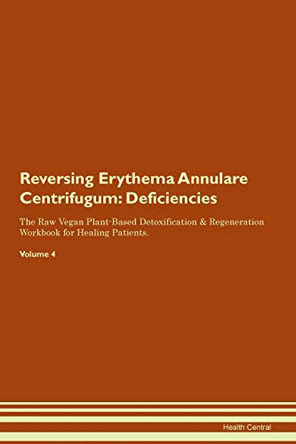 Reversing Erythema Annulare Centrifugum: Deficiencies The Raw Vegan Plant-Based Detoxification & Regeneration Workbook for Healing Patients. Volume 4 by Health Central 9781395364274