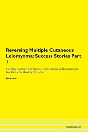 Reversing Multiple Cutaneous Leiomyoma: Success Stories Part 1 The Raw Vegan Plant-Based Detoxification & Regeneration Workbook for Healing Patients. Volume 6 by Health Central 9781395665371