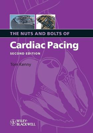 The Nuts and Bolts of Cardiac Pacing by Tom Kenny