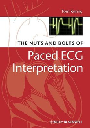 The Nuts and bolts of Paced ECG Interpretation by Tom Kenny