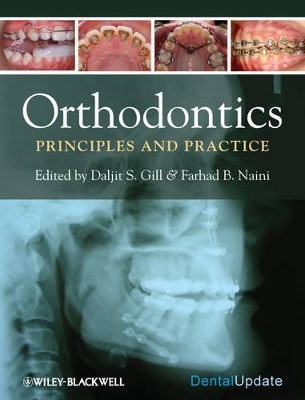 Orthodontics: Principles and Practice by Daljit S. Gill 9781405187473
